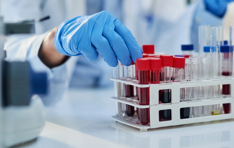 Polska farmacja będzie mogła rywalizować na innowacje z zachodnią. Unia Europejska planuje systemowe wsparcie