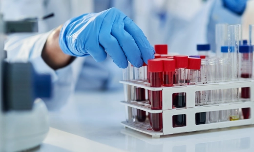 Polska farmacja będzie mogła rywalizować na innowacje z zachodnią. Unia Europejska planuje systemowe wsparcie