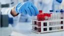Polska farmacja będzie mogła rywalizować na innowacje z zachodnią. Unia Europejska planuje systemowe wsparcie