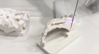 Duży sukces Robotron Surgical Technologies. Światowy gigant przejmuje ich platformę AI